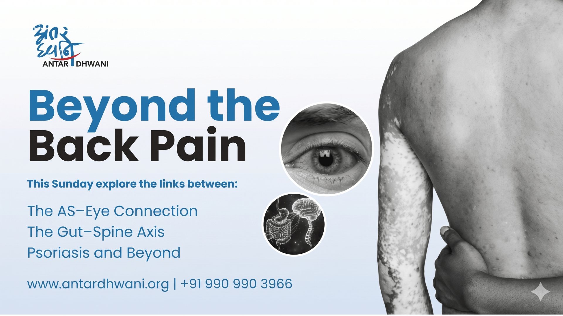 Beyond the Back Pain: Managing the hidden Symptoms of Ankylosing